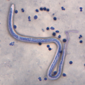 W_bancrofti_ORa.jpg