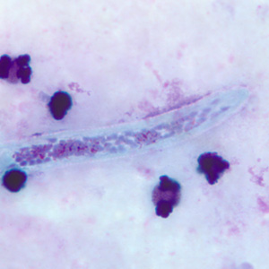 W_bancrofti_anterior_BAM2.jpg