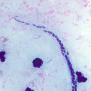 W_bancrofti_posterior_BAM2.jpg
