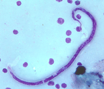B_timori_Giemsa_500x_BAM1.jpg