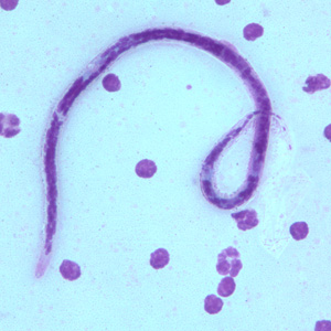 B_timori_Giemsa_500x_BAM2.jpg