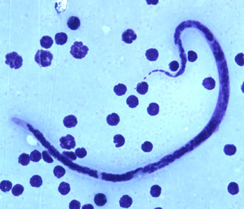 B_timori_Giemsa_500x_BAM3.jpg