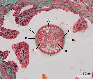 Brugia_A Figure A
