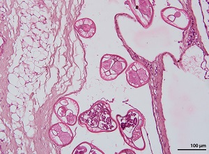 Brugia_C Figure C