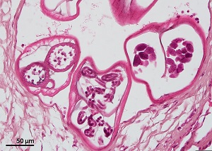 Brugia_D Figure D