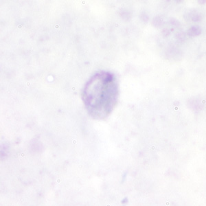 Pm_gametocyte_thickA.jpg