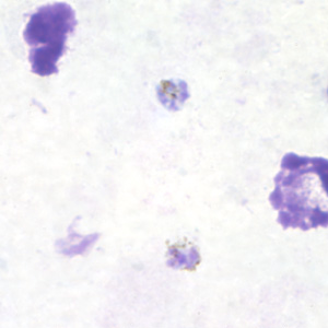 Pm_gametocyte_thickB.jpg