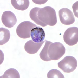 Pm_gametocyte_thinA.jpg