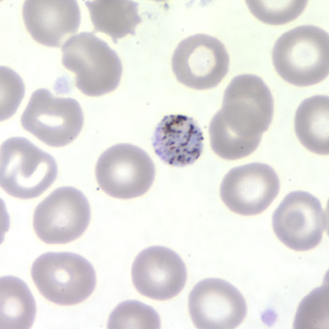 Pm_gametocyte_thinB.jpg