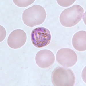 Pm_gametocyte_thinC.jpg