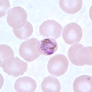 Pm_gametocyte_thinD.jpg