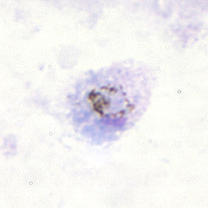 Po_gametocyte_thickA.jpg