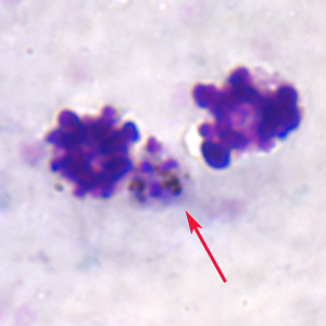 Po_gametocyte_thickB.jpg