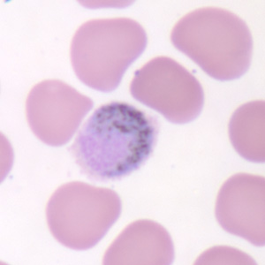 Po_gametocyte_thinB.jpg