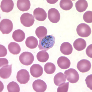 Po_gametocyte_thinC.jpg