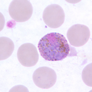 Po_gametocyte_thinF.jpg