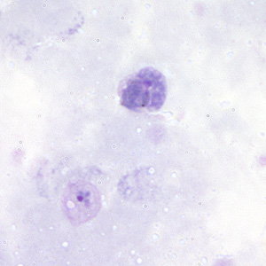 Pv_gametocyte_thickA.jpg