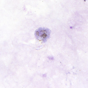 Pv_gametocyte_thickB.jpg
