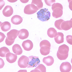 Pv_gametocyte_thinA.jpg