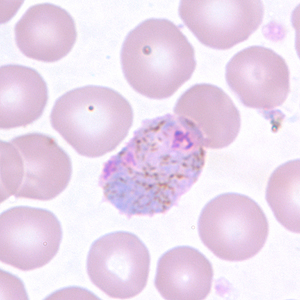 Pv_gametocyte_thinB.jpg