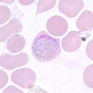 Pv_gametocyte_thinD.jpg