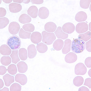 Pv_gametocyte_thinE.jpg