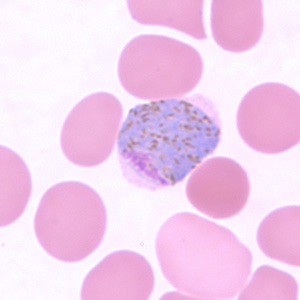 Pv_gametocyte_thinF.jpg