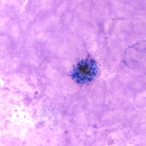 Pv_schizont_thickB.jpg