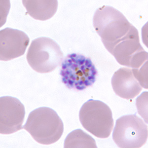 Pv_schizont_thinC.jpg