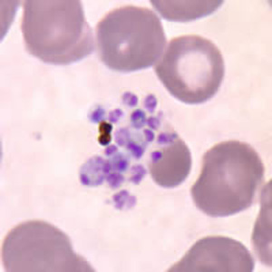 Pv_schizont_thinD.jpg