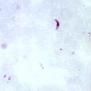 Pf_gametocyte_thickA.jpg