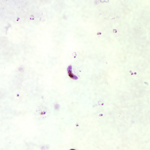 Pf_gametocyte_thickB.jpg