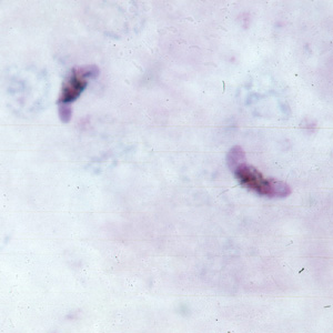 Pf_gametocyte_thickC.jpg