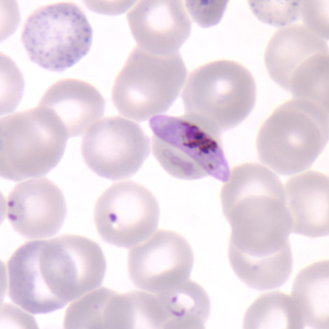 Pf_gametocyte_thinA.jpg