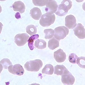 Pf_gametocyte_thinB.jpg
