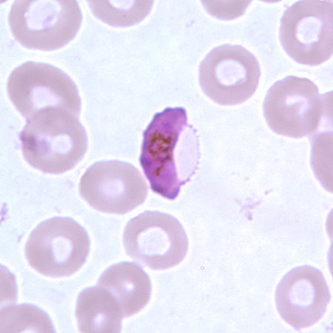 Pf_gametocyte_thinC.jpg