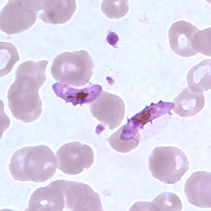 Pf_gametocyte_thinD.jpg