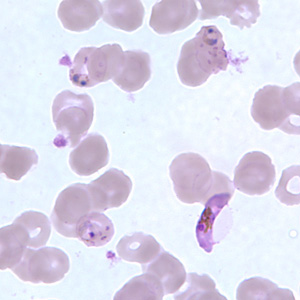 Pf_gametocyte_thinE.jpg