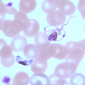 Pf_gametocyte_thinF.jpg