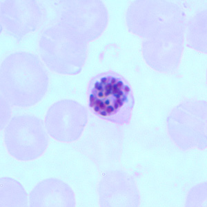 Pf_schizont_thinA.jpg