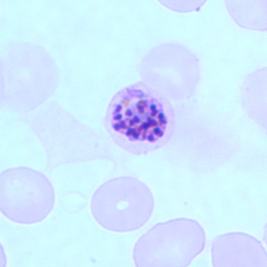 Pf_schizont_thinB.jpg