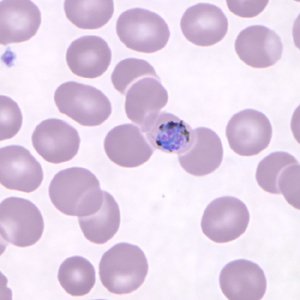 Pk_gametocyte_thin_NY1.jpg