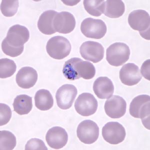 Pk_gametocyte_thin_NY2.jpg