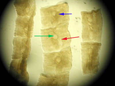 Mesocestoides_dog_AZPHL_B.jpg