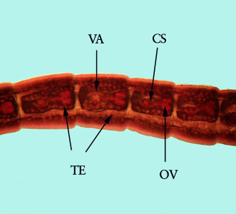 Mesocestoides_proglottid_BAM2.jpg