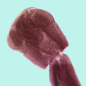 Mesocestoides_scolex_BAM.jpg
