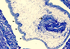 C Figure C