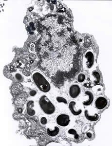Eintestinalis_spores_EM_2012.jpg