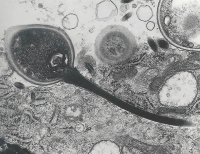 msp_tubule_EM2_2012.jpg