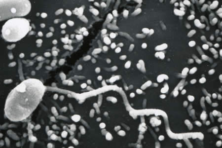 msp_tubule_EM_2012.jpg